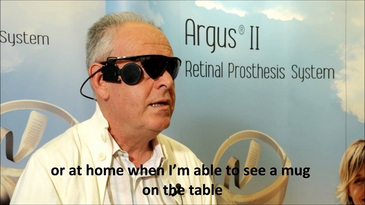  ARGUS II &ndash; яркий пример эпиретинального подхода 